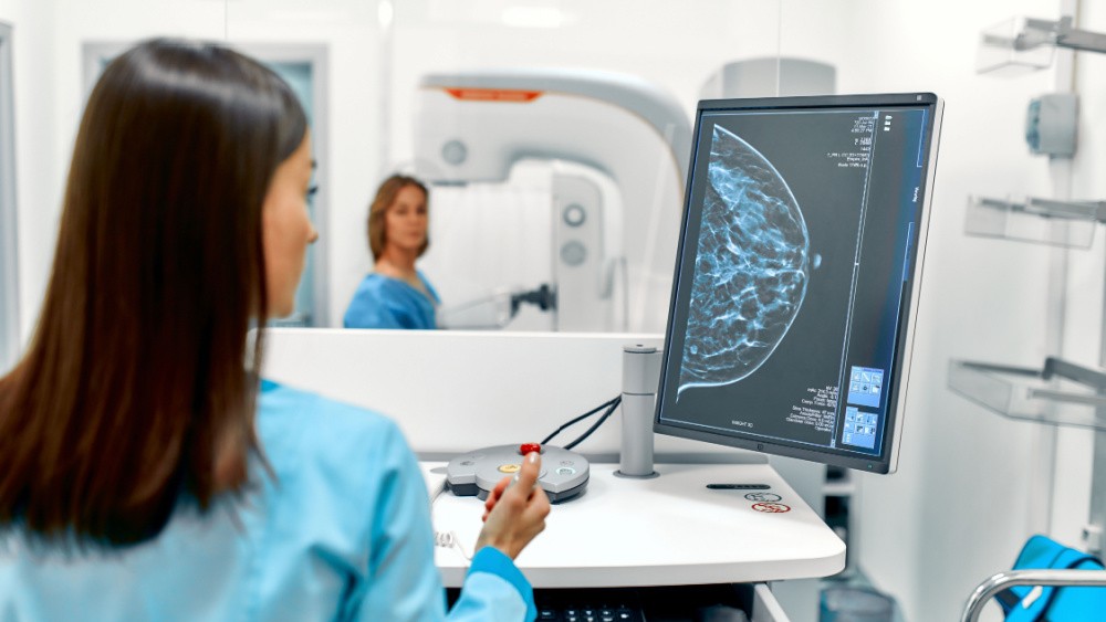 women taking a mammography while a technician checks breast imaging